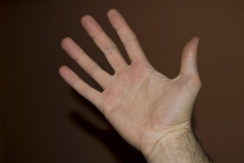 Hand