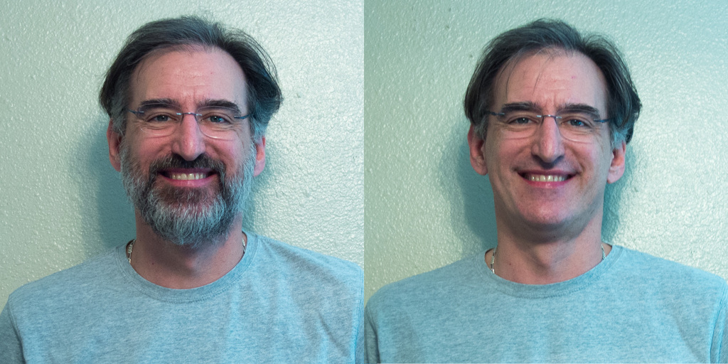 Before and after